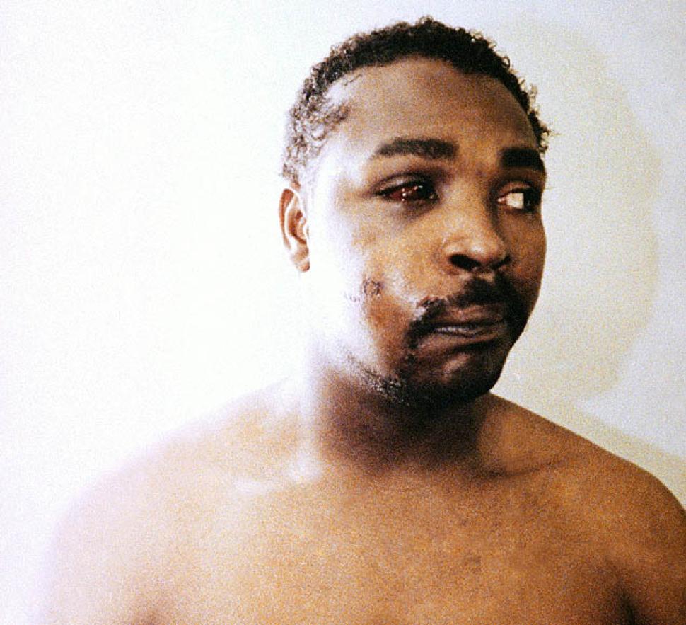 RODNEY KING (APPEARANCE 3 DAYS AFTER BEATING 3.6.92--KING DIES IN JUNE 2012 @ 47 YEARS OF AGE)